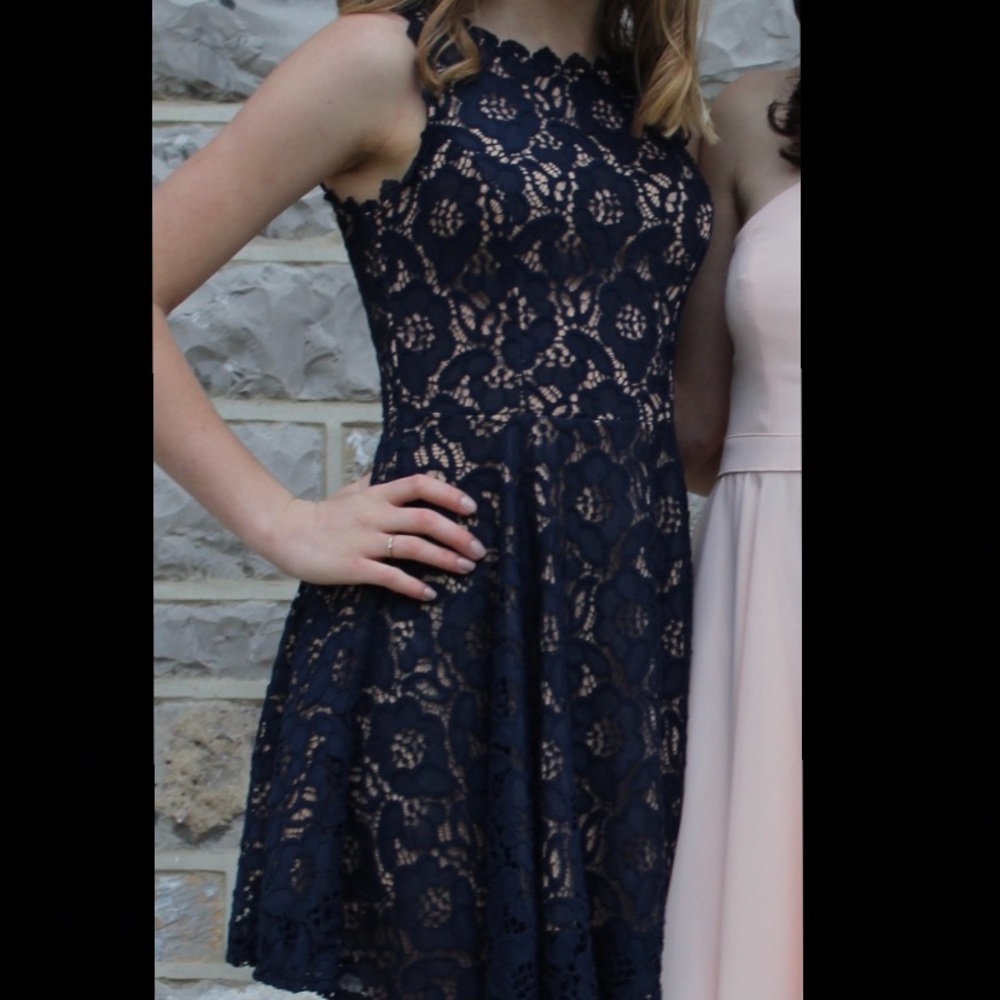 ⭐️Navy Blue Lace Hoco Dress